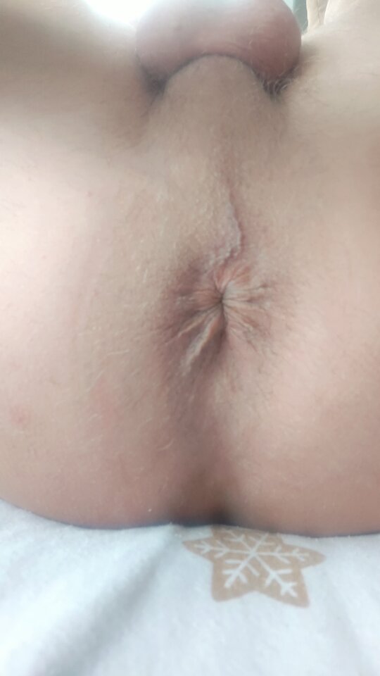 1000016977.jpg - Lesio5555