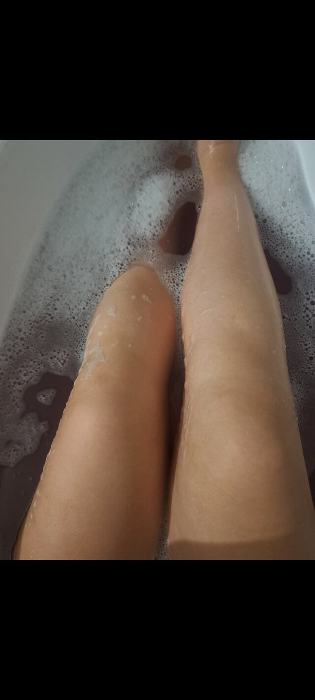 GoracaZonkaa