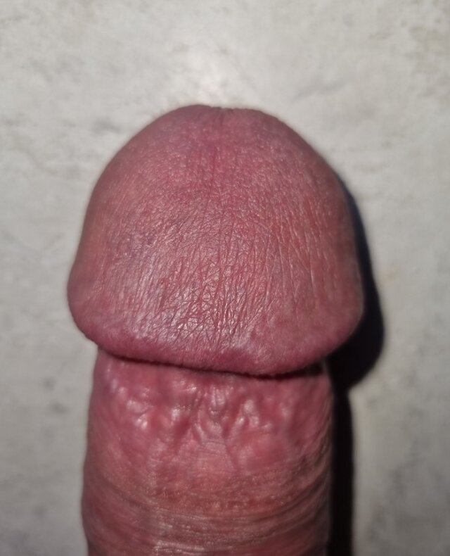 Alan7