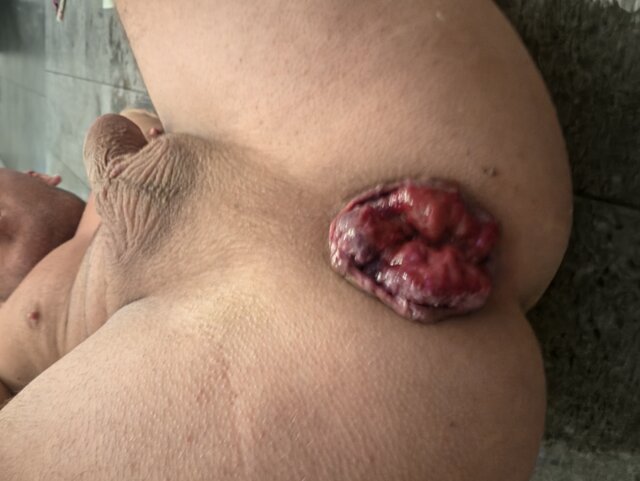 Magic_Holes