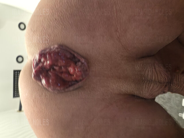 Magic_Holes